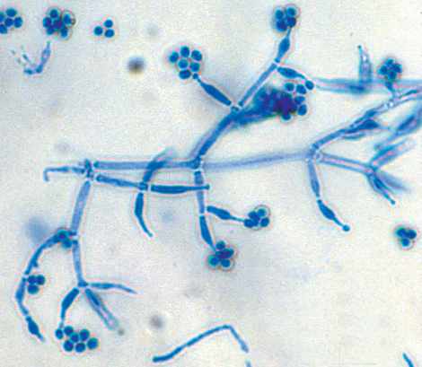 Trichoderma | Mycology | Adelaide University