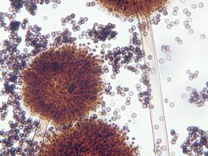 Conidial heads of A. niger. Note: conidial heads are biseriate, large, globose, dark brown, becoming radiate with the phialides borne on metulae.