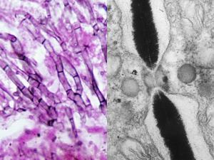 Simple septal pores of an Ascomycete showing characteristic Woronin bodies which can plug the pore in the event of injury to the hyphal segment.