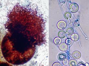 Cleistothecium of Emericella nidulans (anamorph A. nidulans) showing numerous reddish-brown ascospores. Cleistothecia of A. nidulans are often surrounded by a mass of Hülle cells.