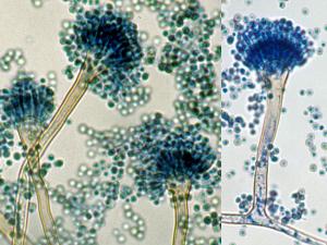 Conidial head of A. nidulans. Note: conidial heads are short, columnar and biseriate. Conidiophores are usually short, brownish and smooth-walled. Conidia are globose and rough-walled.