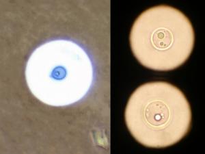 India ink preparation of CSF showing a typical yeast cell of C. neoformans surrounded by a characteristic wide gelatinous capsule