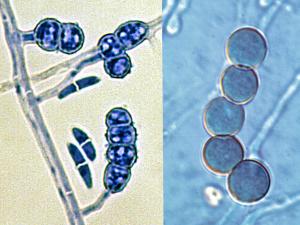 Chlamydoconidia