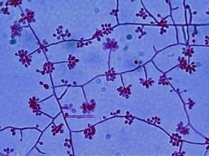 Sporothrix morphology