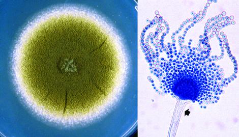 Culture and conidial head of Aspergillus flavus