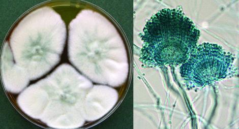 Aspergillus lentulus culture and conidial heads.