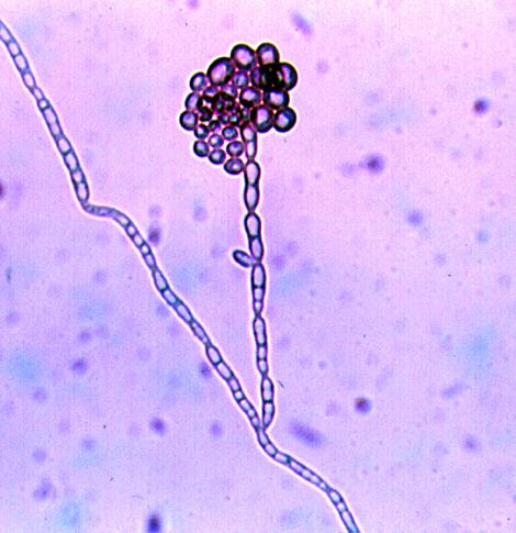 Annellide and conidia of Exophiala dermatitidis