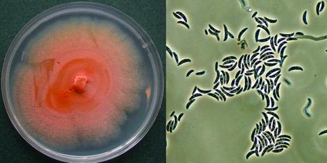 Fusarium dimerum complex