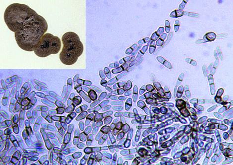 Conidia of Hortaea werneckii