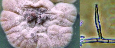 Phaeoacremonium parasiticum