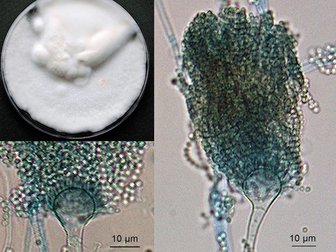 Aspergillus Nidulans Microscopic Morphology Aspergillus Nidulans Microscopic Morphology