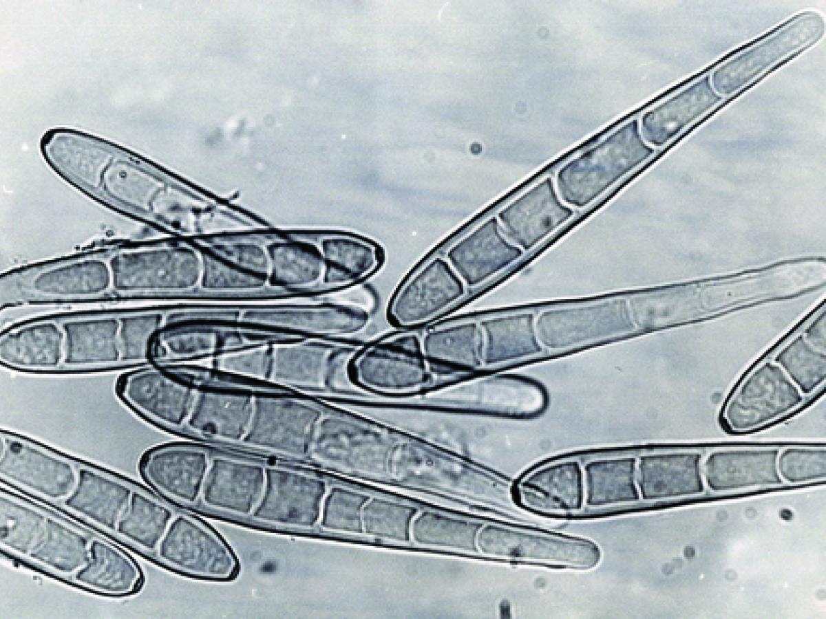 Conidia of Drechsler spp