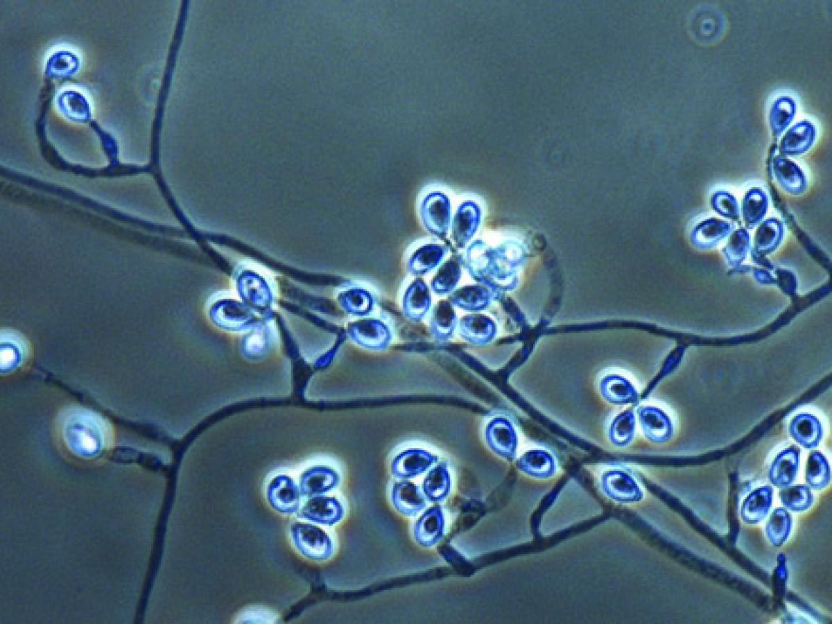 Lomentospora prolificans conidiophores and conidia