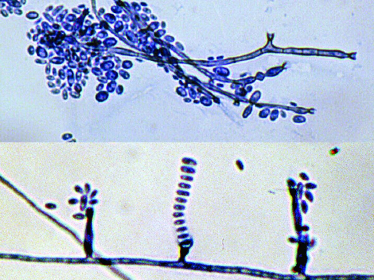 Phialides and conidia of P. verrucosa