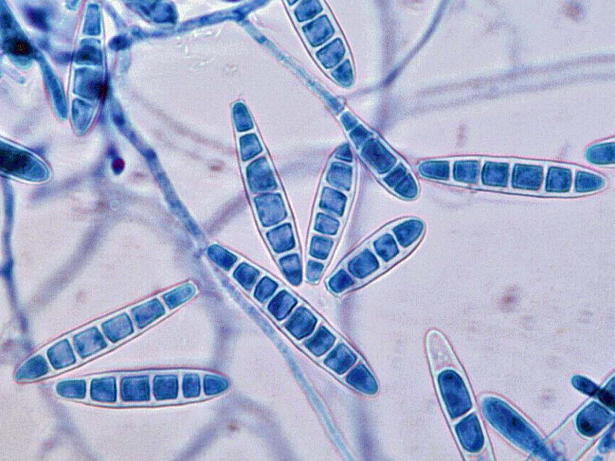 Arthroderma uncinatum microscopy