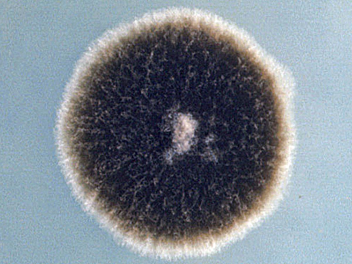 Alternaria culture