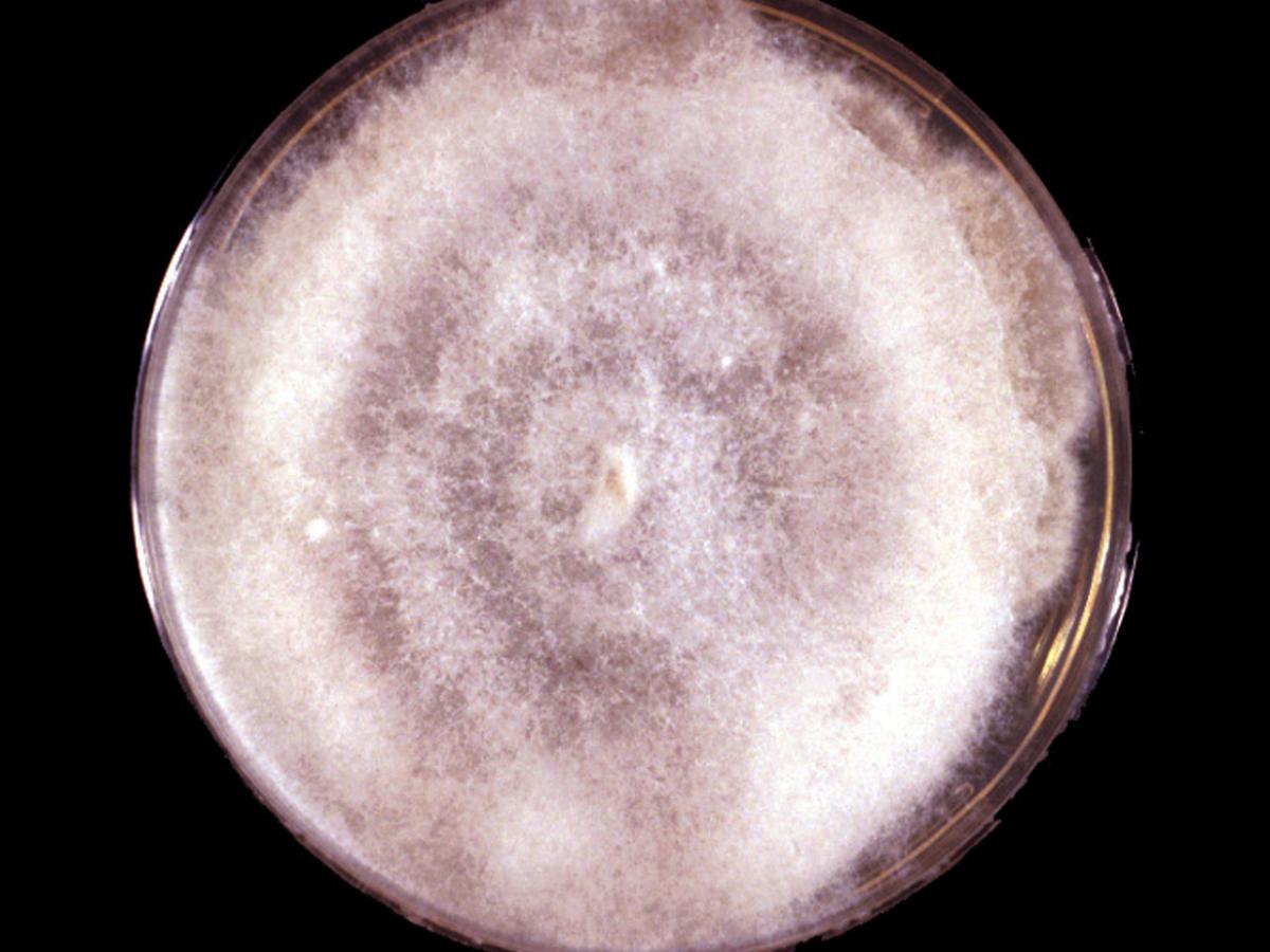 Apophysomyces culture