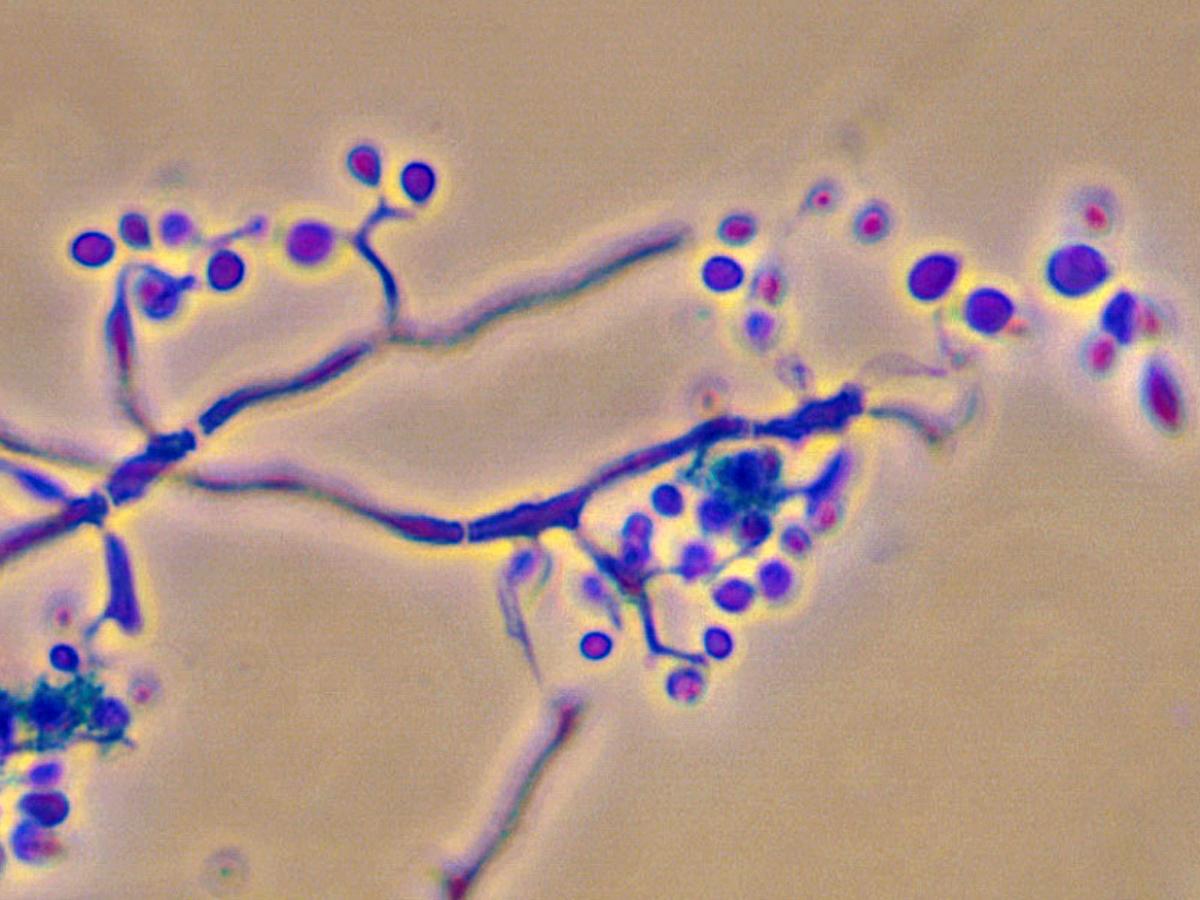 Beauvaria bassiana showing sympodial development of conidia 