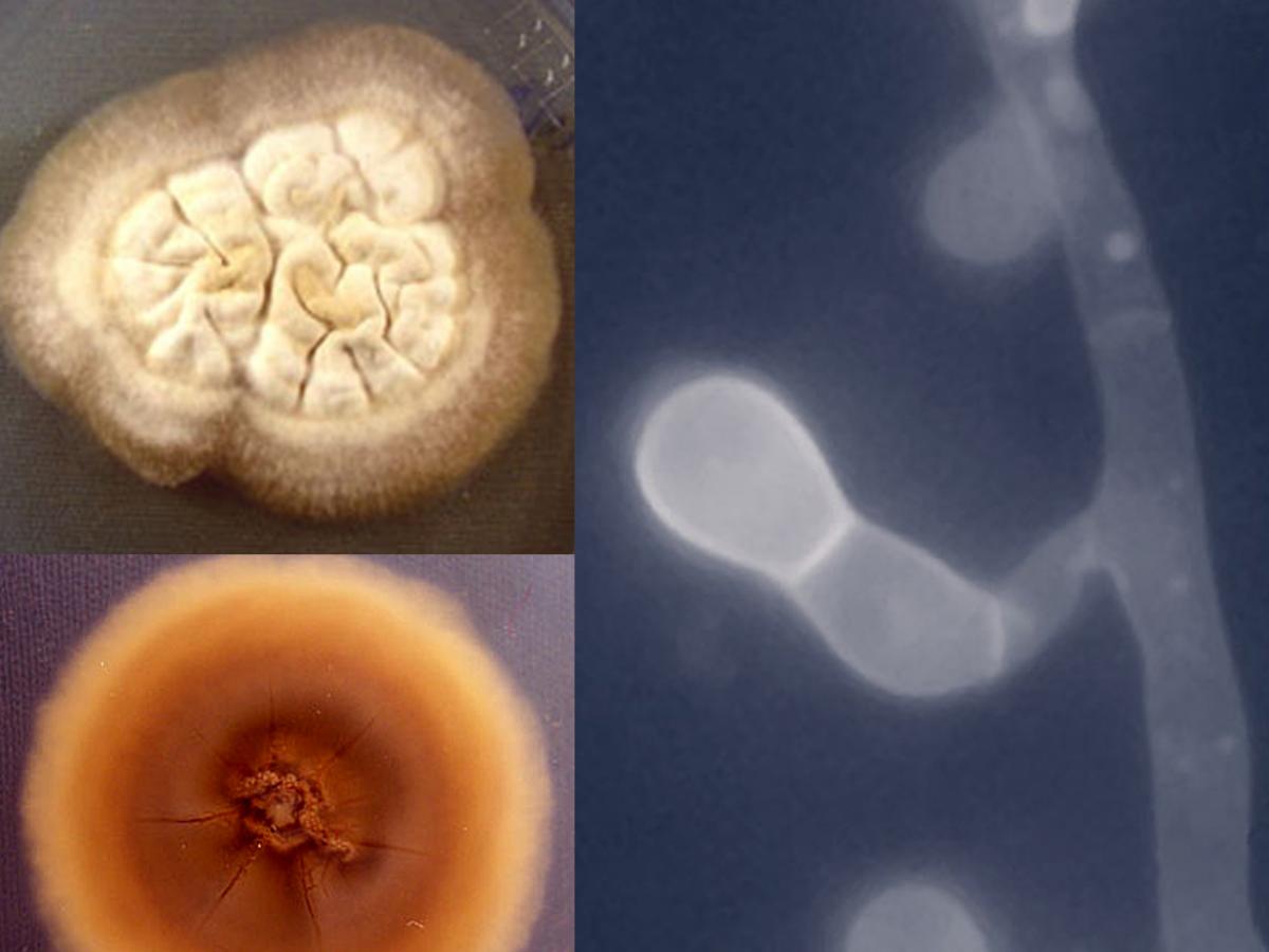 Blastomyces culture
