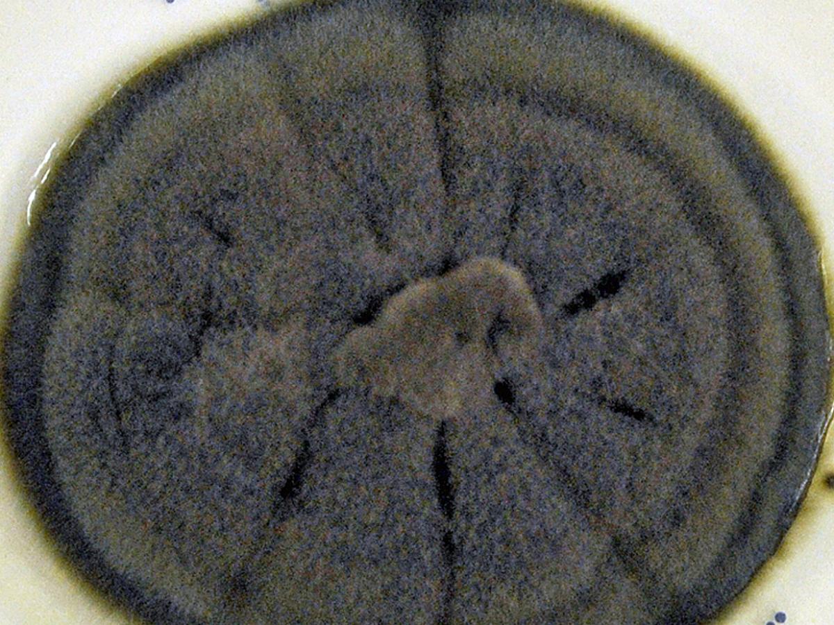 Cladophialophora bantiana culture.