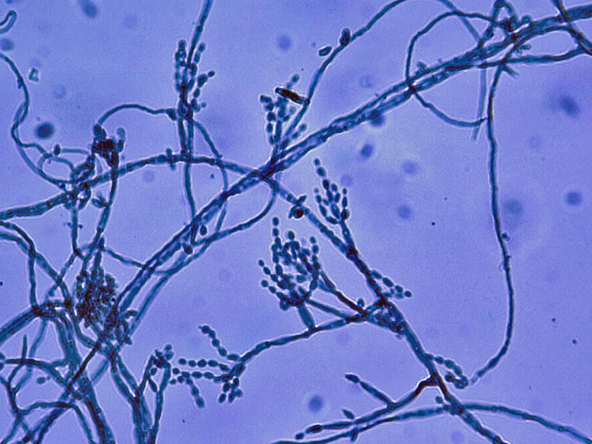 Conidiophores and conidia of  C. carrionii.