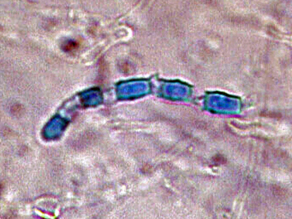 Coccidioides conidia