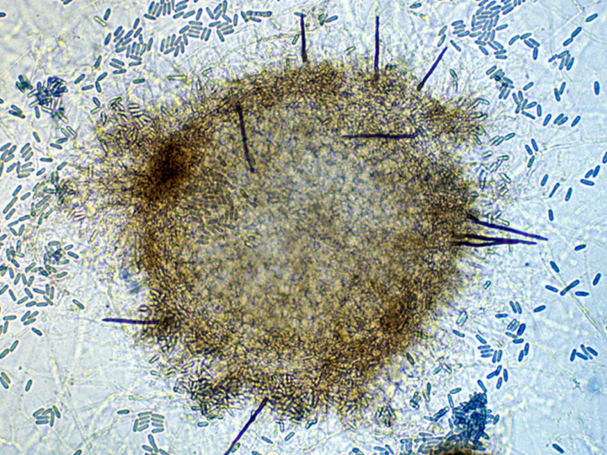Colletotrichum sclerotia