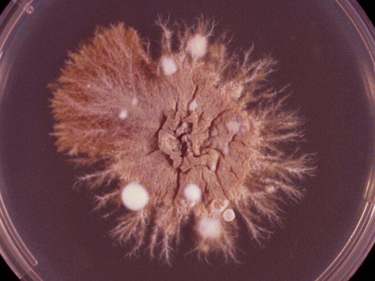 Epidermophyton culture