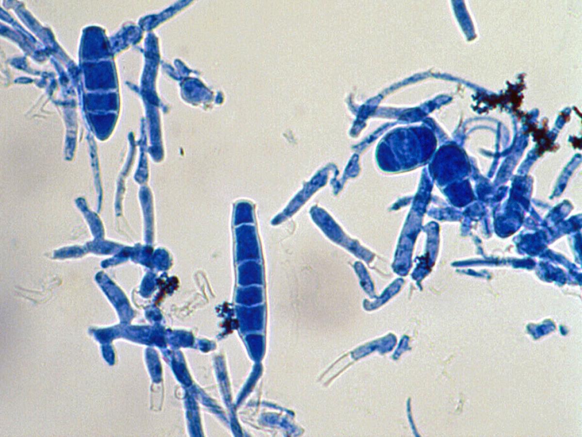 gallinae microscopy