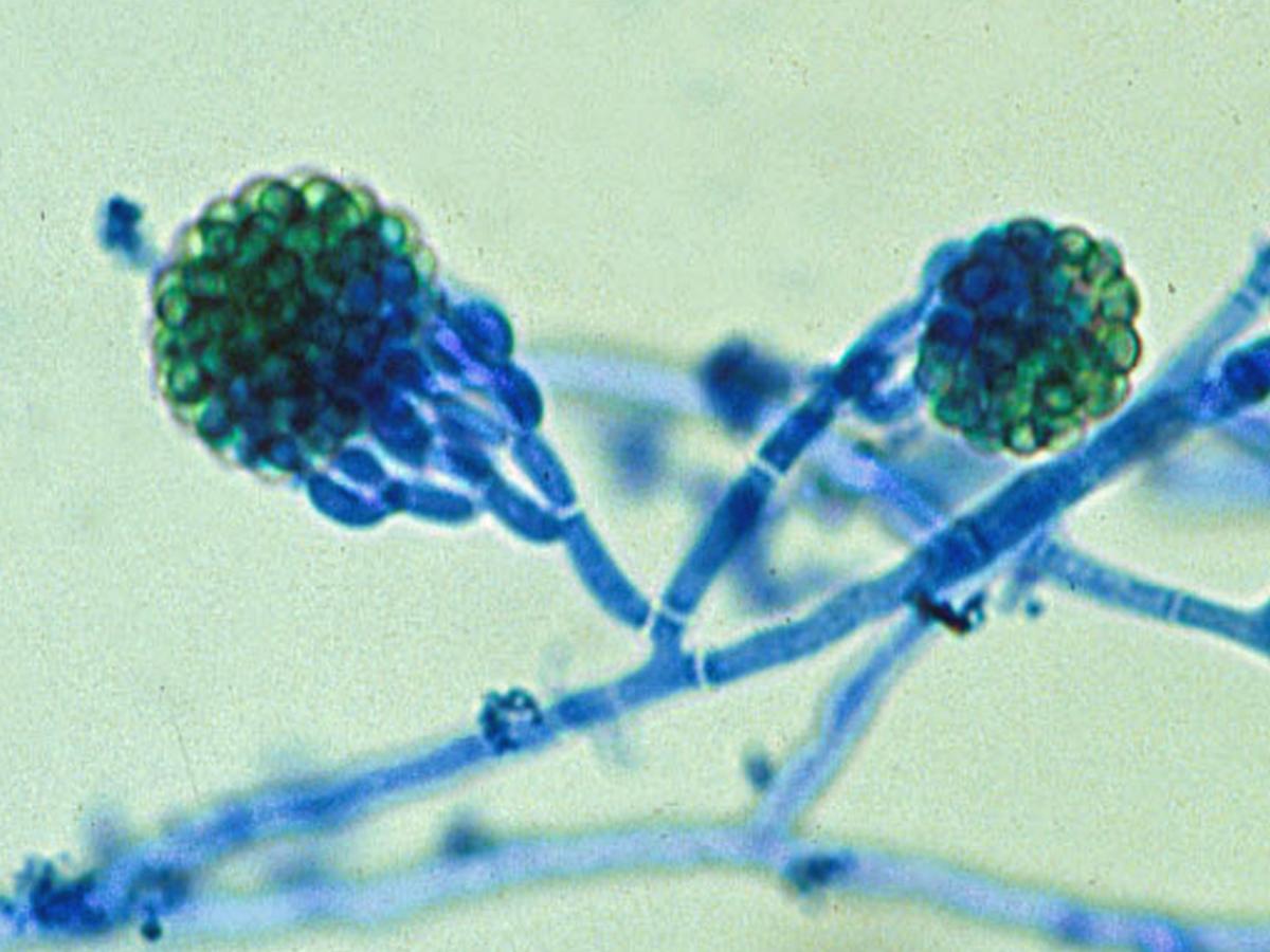 Conidiophore of Gliocladium