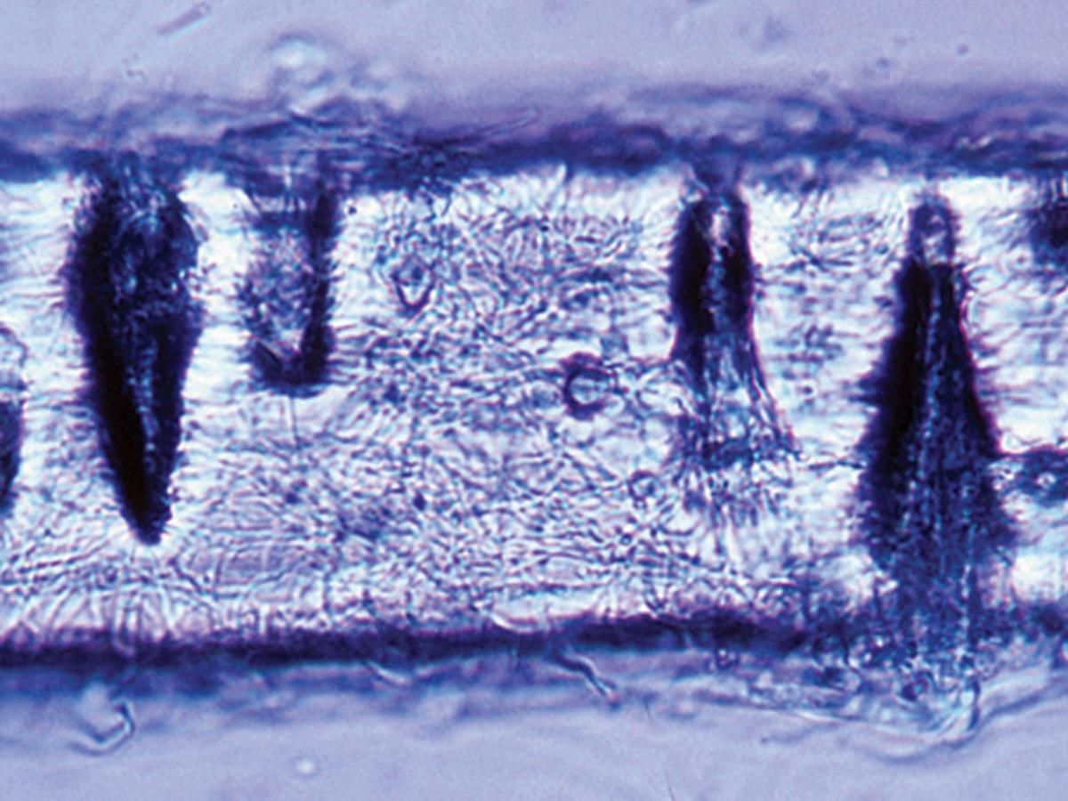 Hair perforation test.
