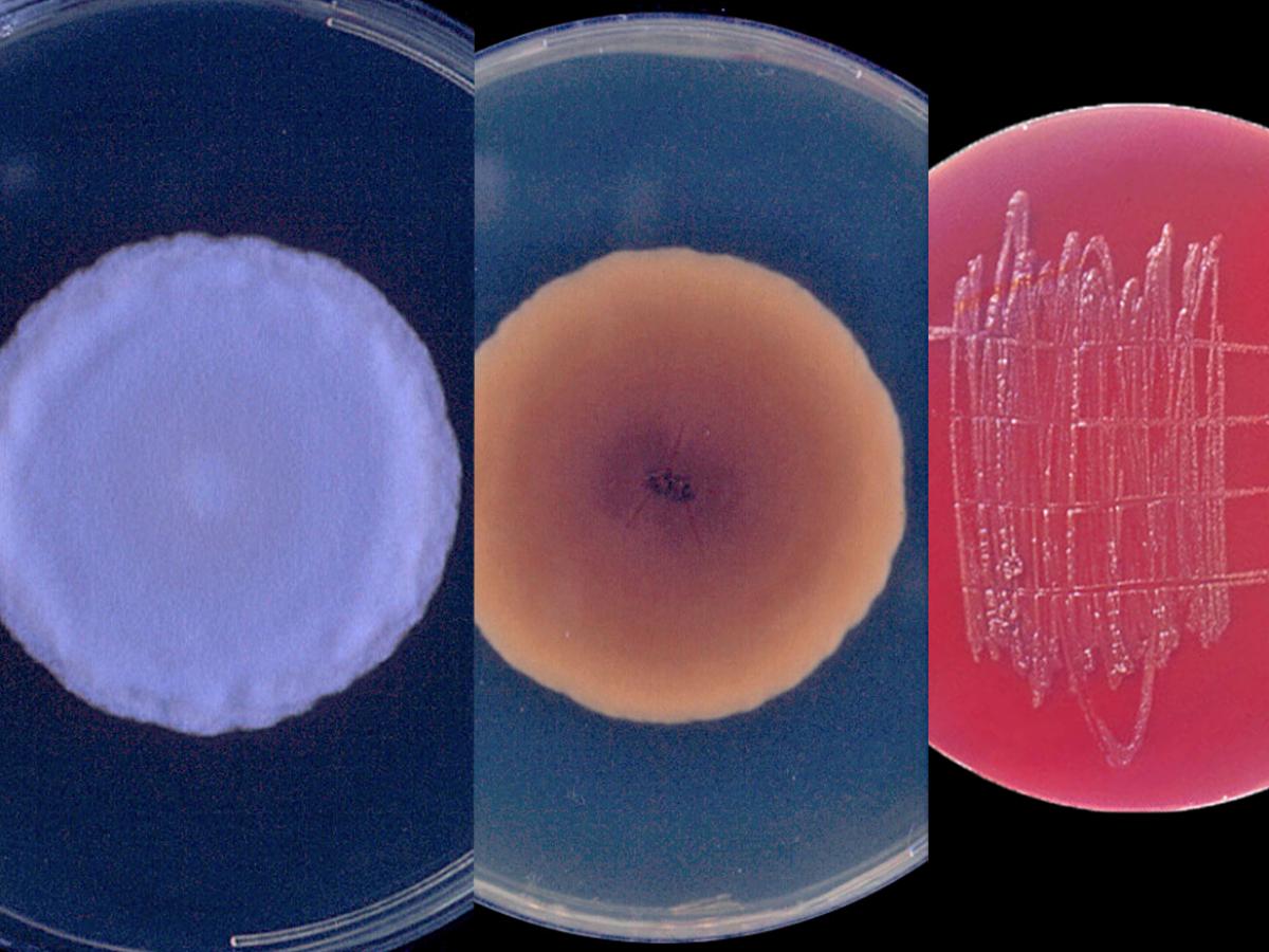 Culture of Histoplasma capsulatum 