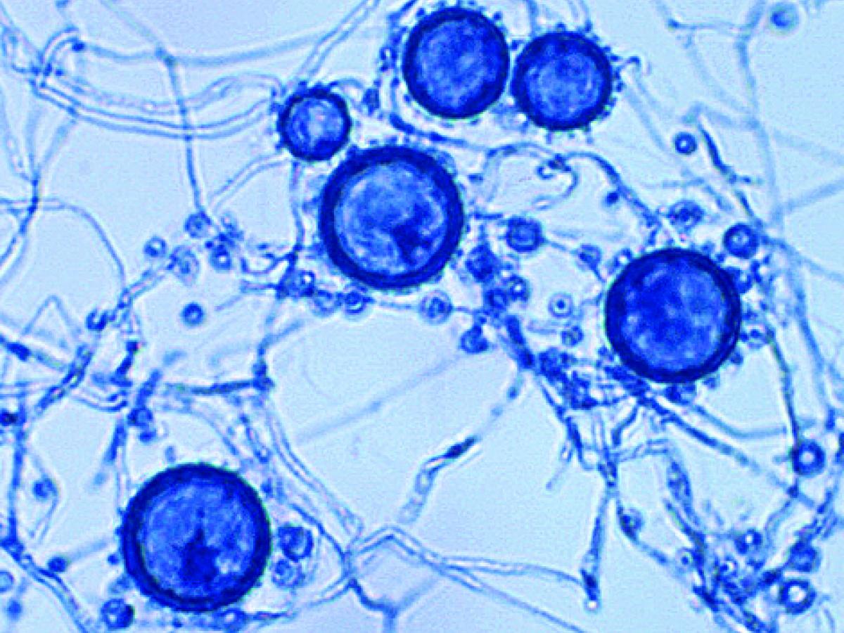Histoplasma microscopy