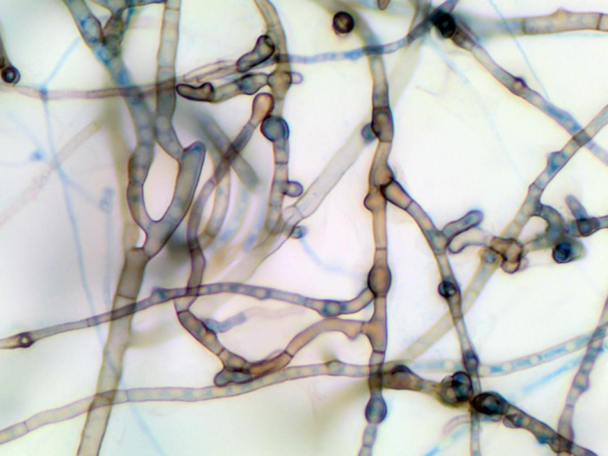 Microsphaeropsis micro
