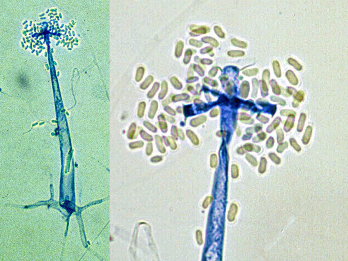 Mortierella microscopy