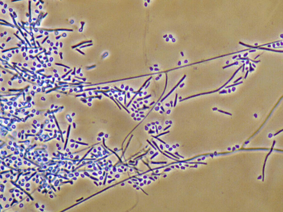 Nannizzia persicolor microscopy