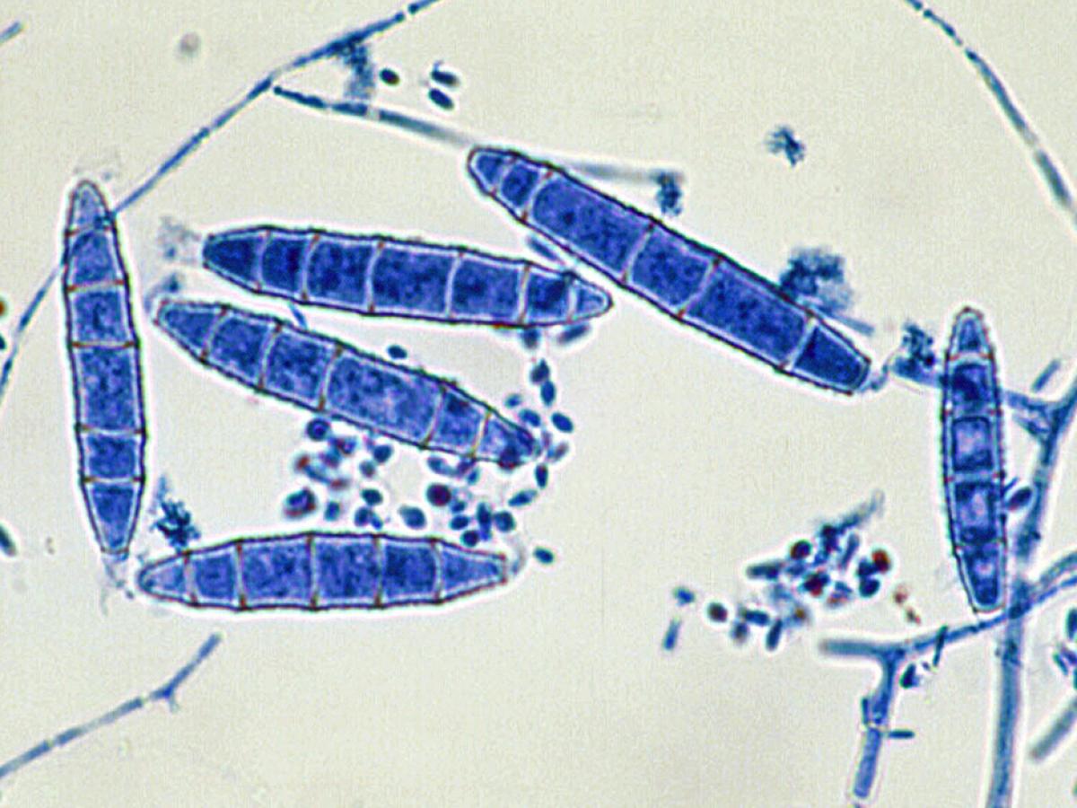 Nannizzia fulva microscopy