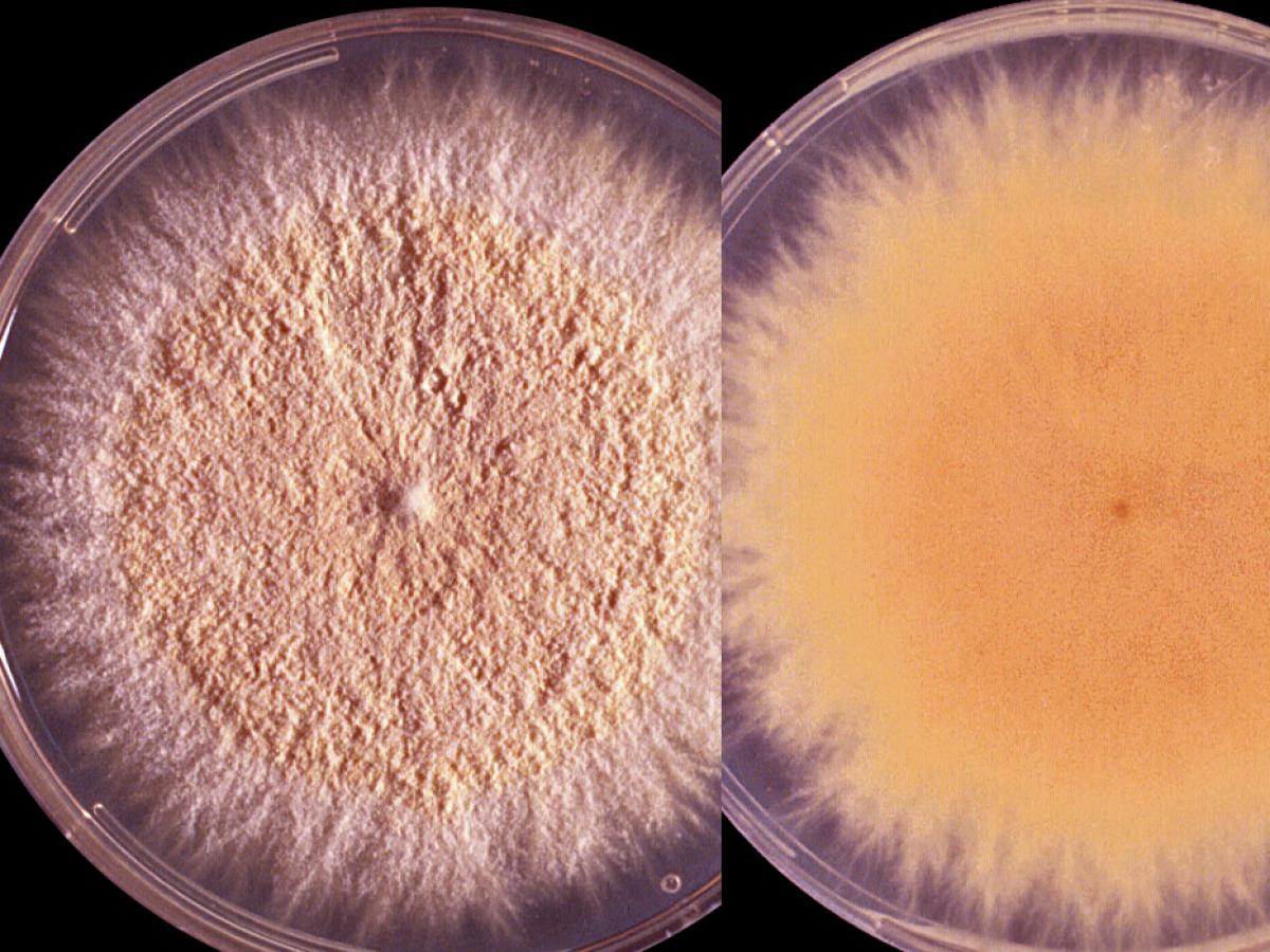 Microsporum gypsea culture