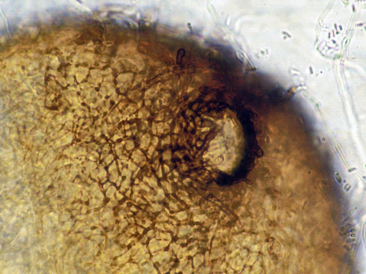 Phoma pycnidium
