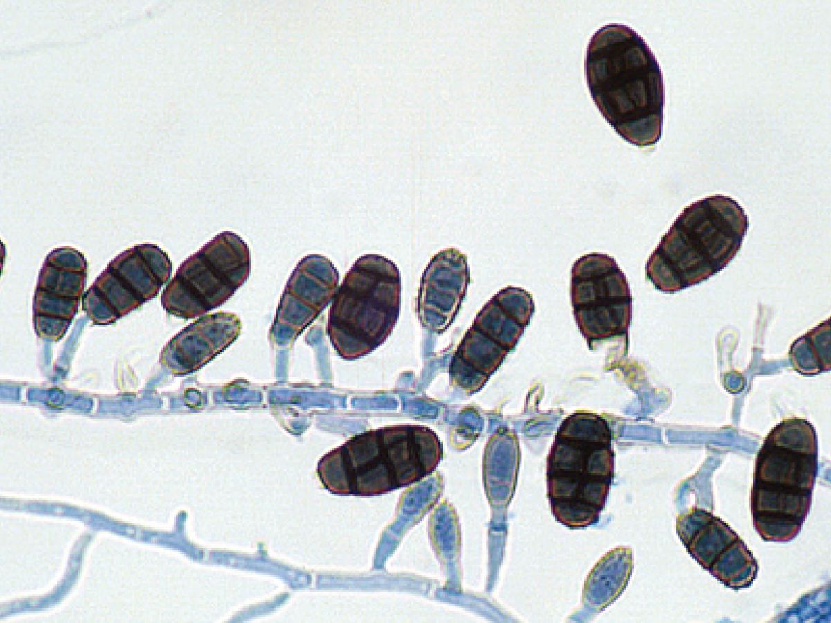 Conidiophore and conidia of Pithomyces chartarum.