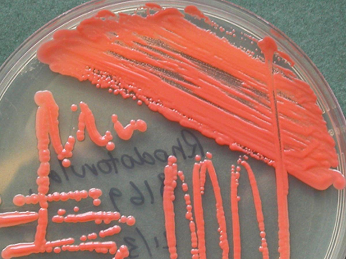 Rhodotorula culture