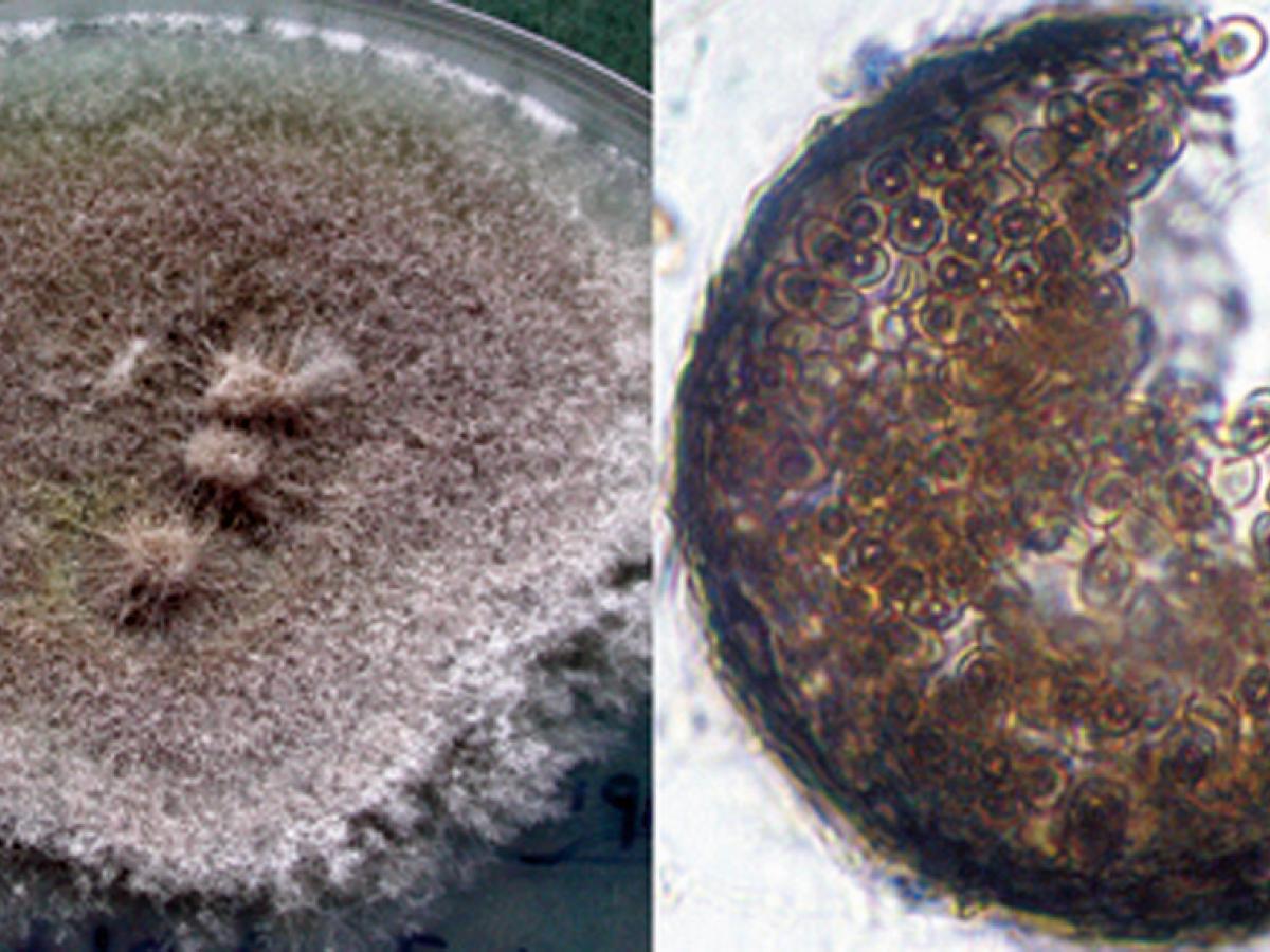 S .boydii morphology