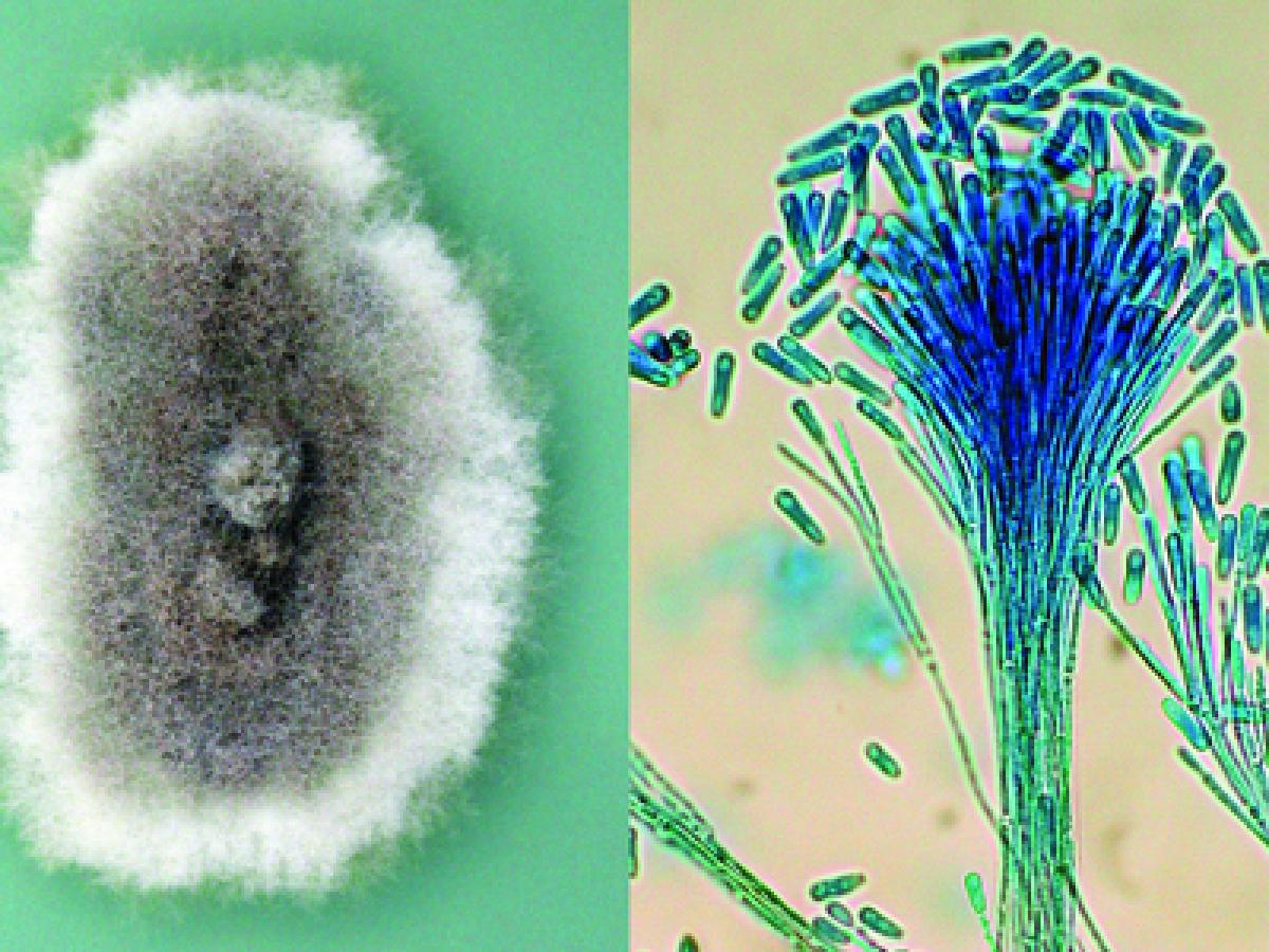 S. apiospermum culture