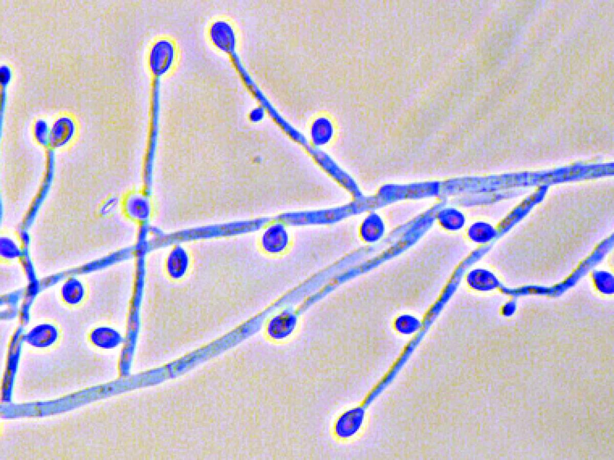 S. apiospermum microscopy