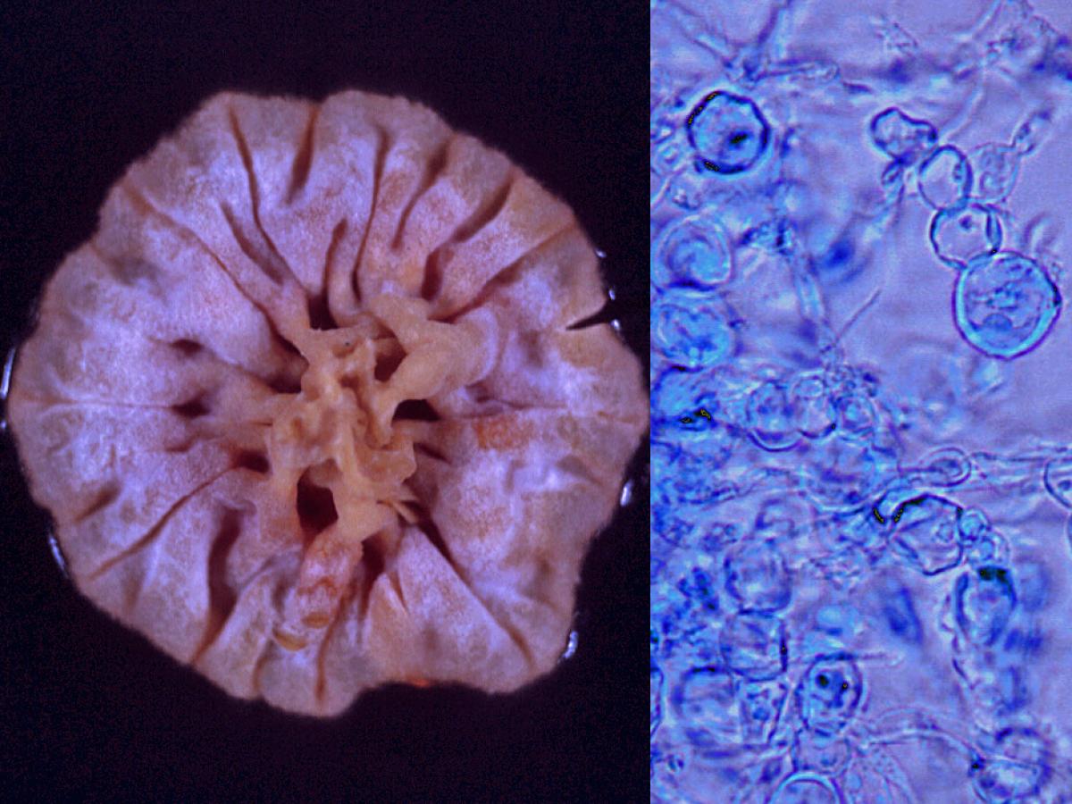 Trichophyton concentricum culture