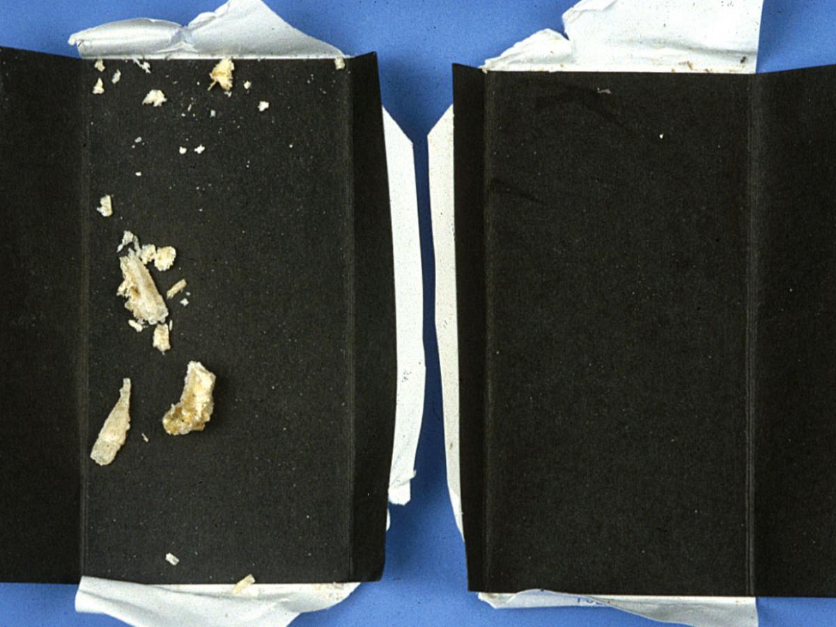 Black collection card showing (a) a suitable amount of nail material for a good sample and (b) an inadequate specimen.