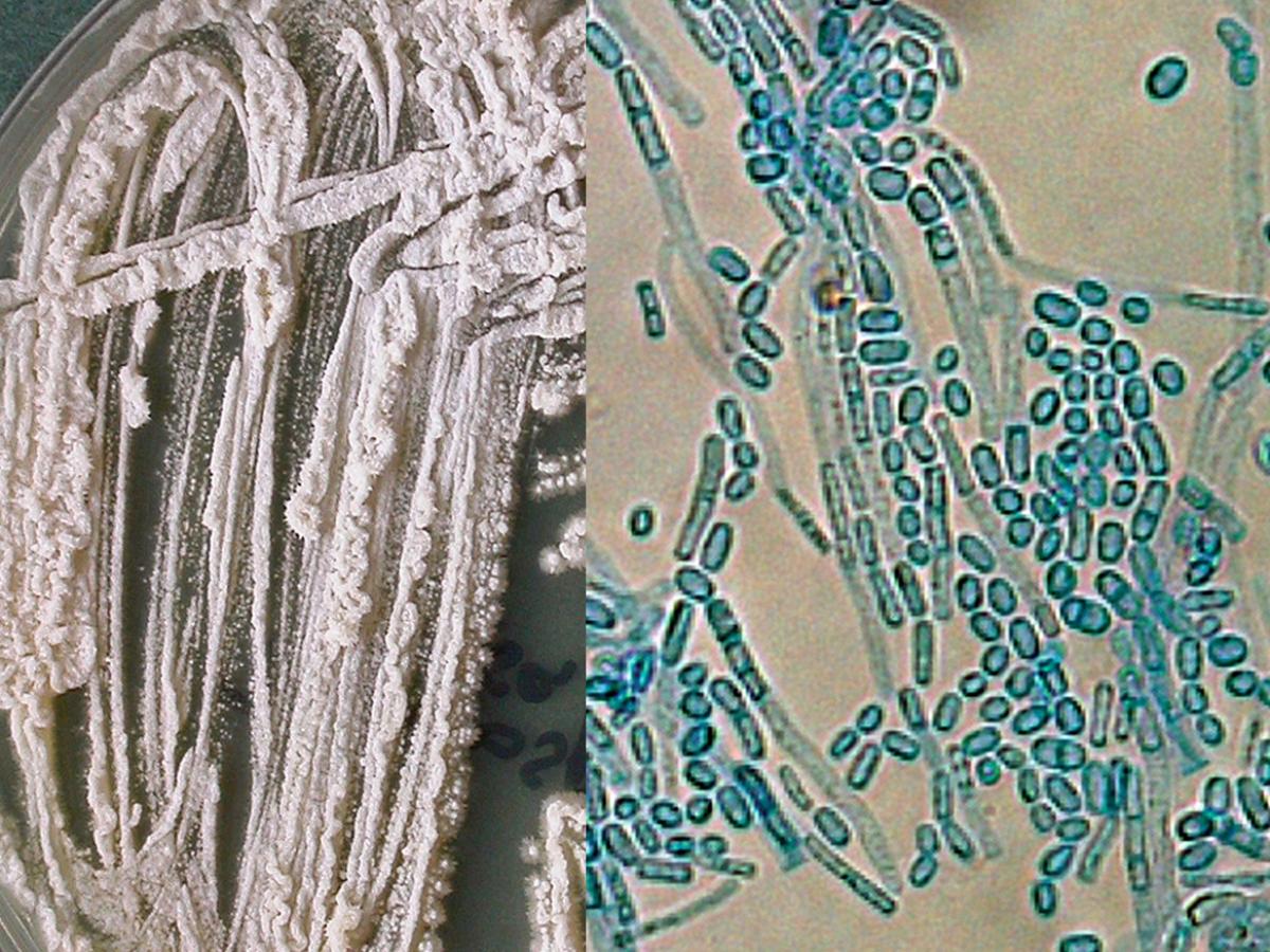 Trichosporon asahii