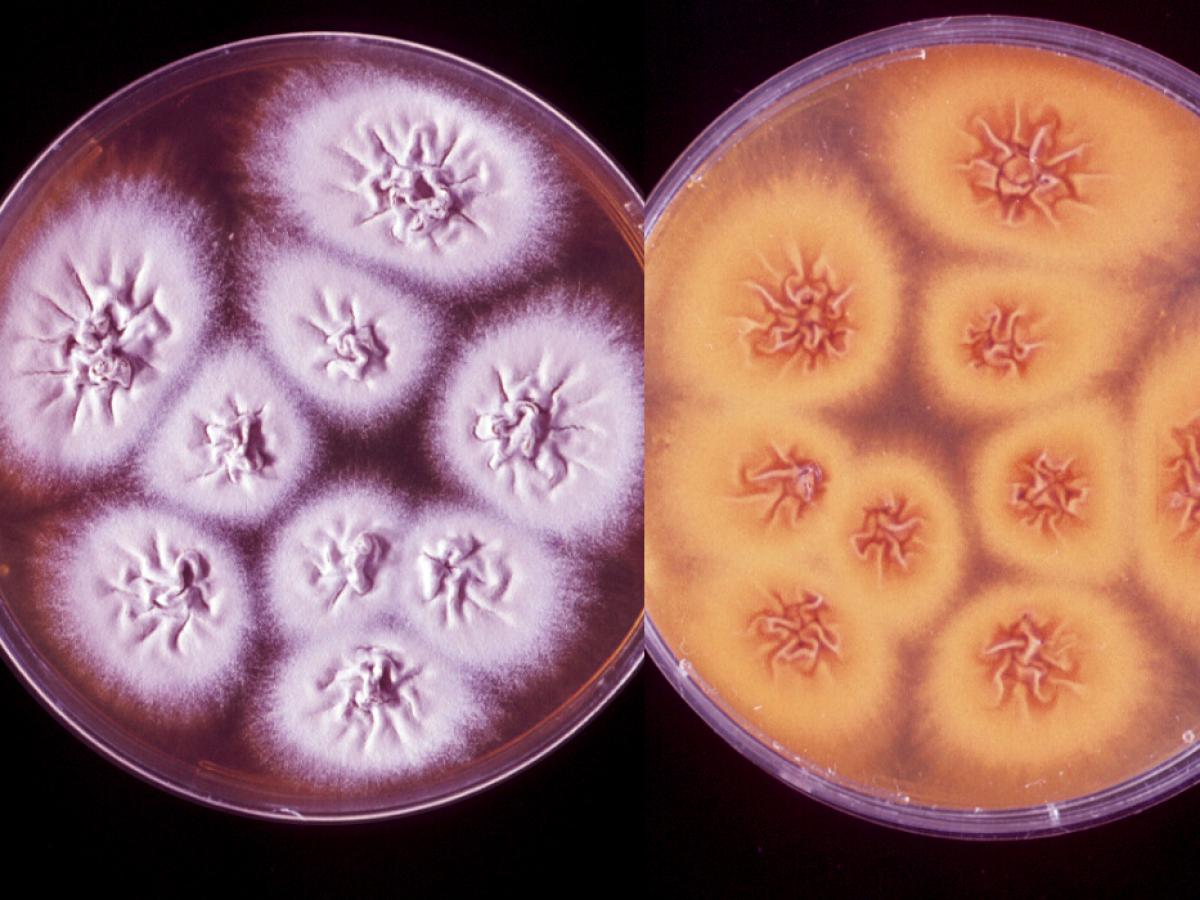 Trichophyton quinkeanum culture