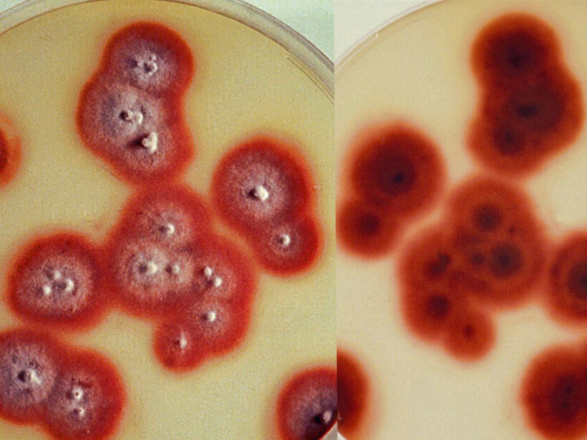 Trichophyton rubrum culture3