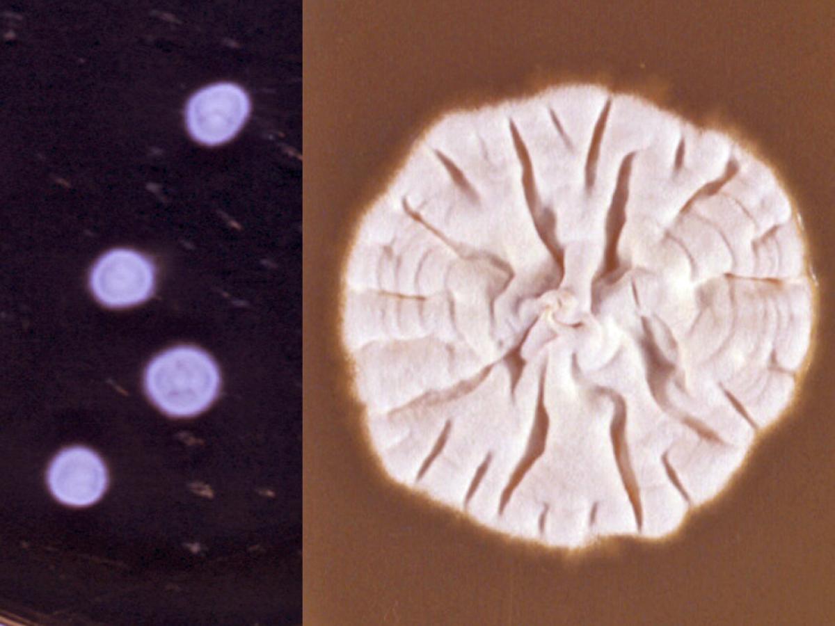 Trichophyton verrucosum culture